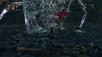 5 amygdala...