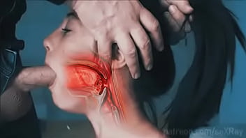 Xray...